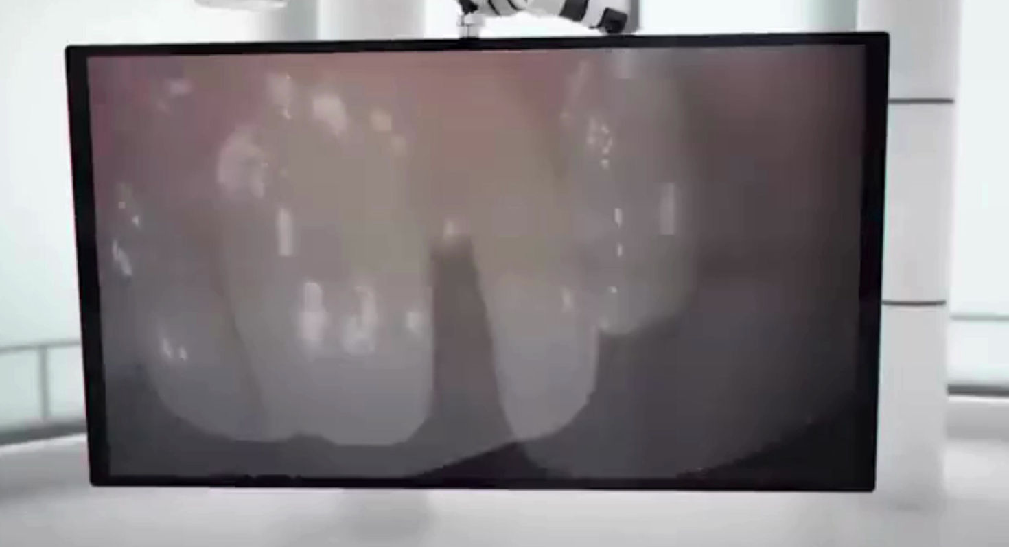 equipo de camara intraoral